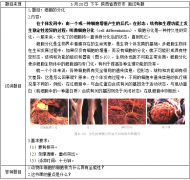 2018上半年高中生物教师资格面试真题:细胞的分化